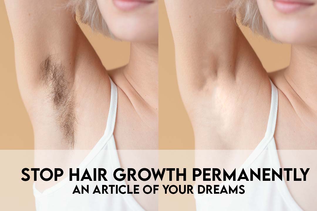 Stop Hair Growth Permanently - An Article of Your Dreams
